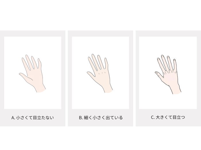 骨格診断画像